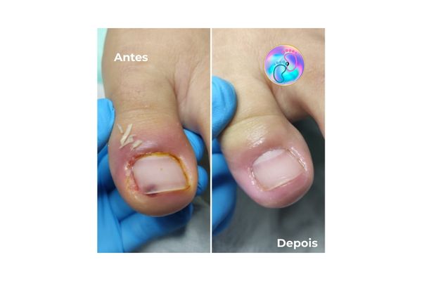 Foto de antes e depois do tratamento 12